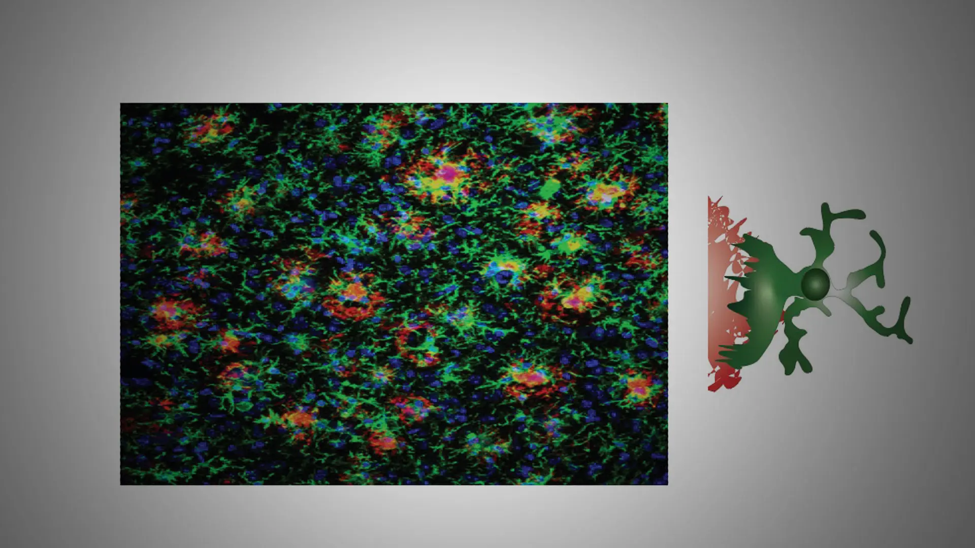 Microglia in Brain Aging: From Guardians to Adversaries, and Back Again