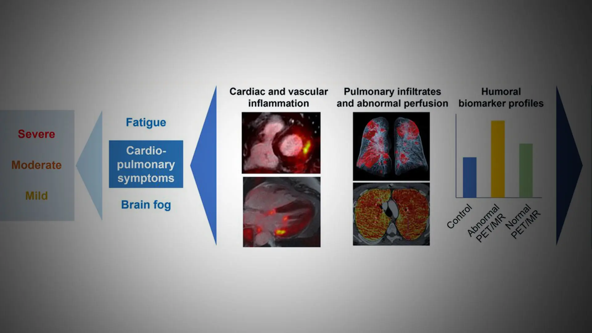 Persistent Cardiovascular and Pulmonary Abnormalities Found in PET/MRI Imaging in Long COVID Patients