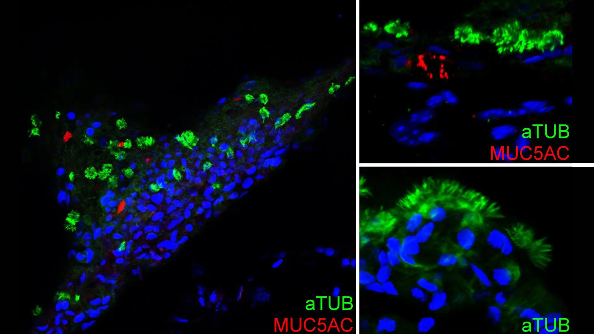 Immunofluorescence staining of hPSC-basal cells after two months of air-liquid interface culture showing differentiation of basal cells into goblet cells (MUC5AC) and ciliated cells (aTUB). 