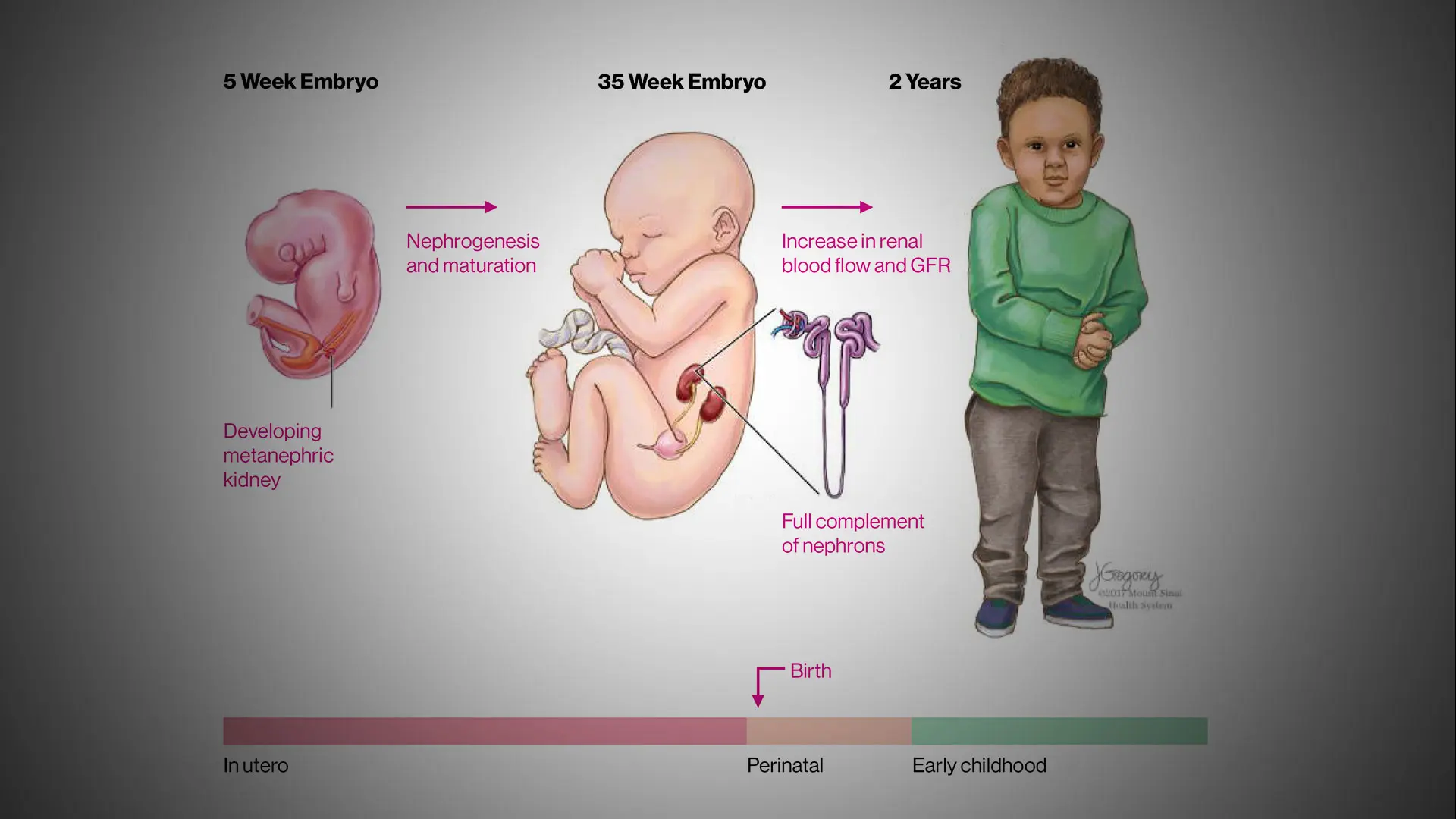 The Greatest Environmental Risk Factors for Kidney Health: What the  Latest Studies Reveal About Fetal, Infant, and Childhood Exposures