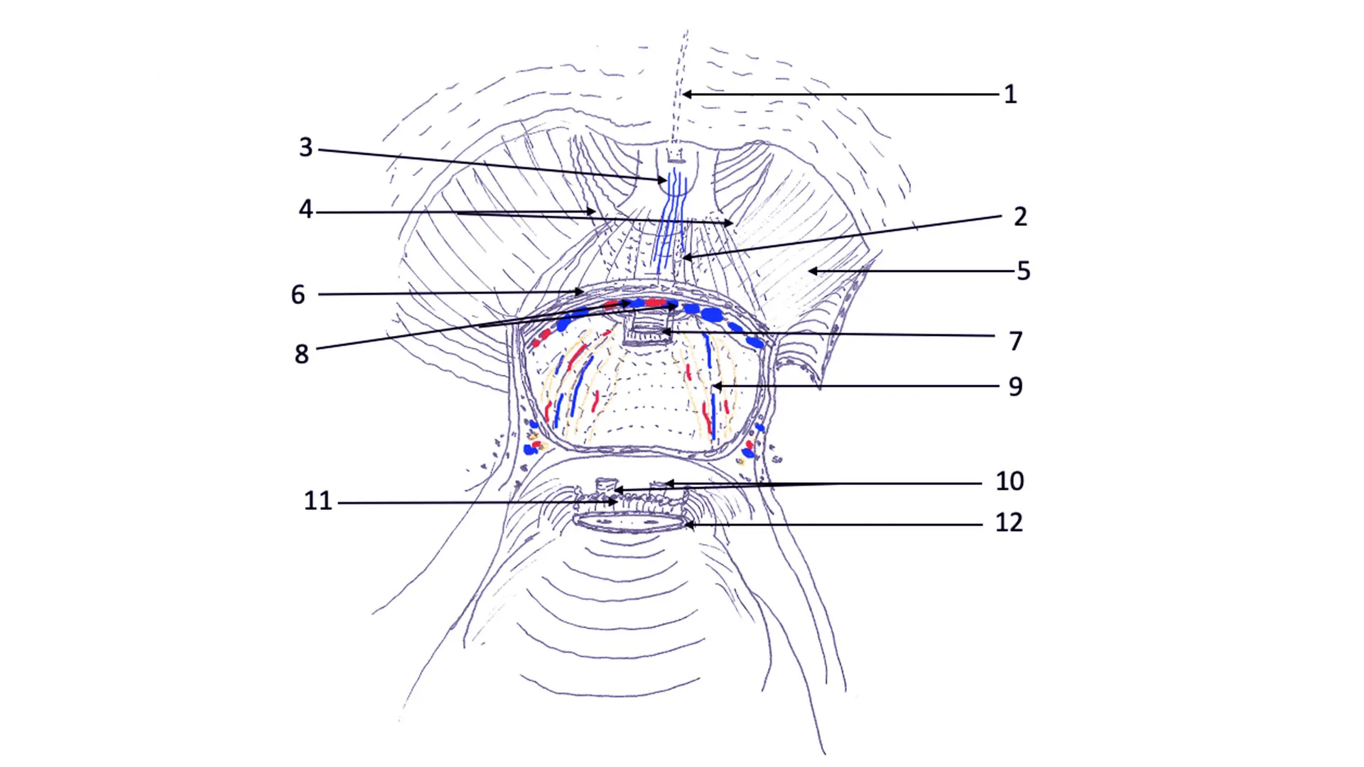 Sketch demonstrating Hood surgical anatomy. Anatomical components of Hood surrounds and safeguards membranous urethra and external urethral sphincter and thereby urethrovesical anastomosis. 