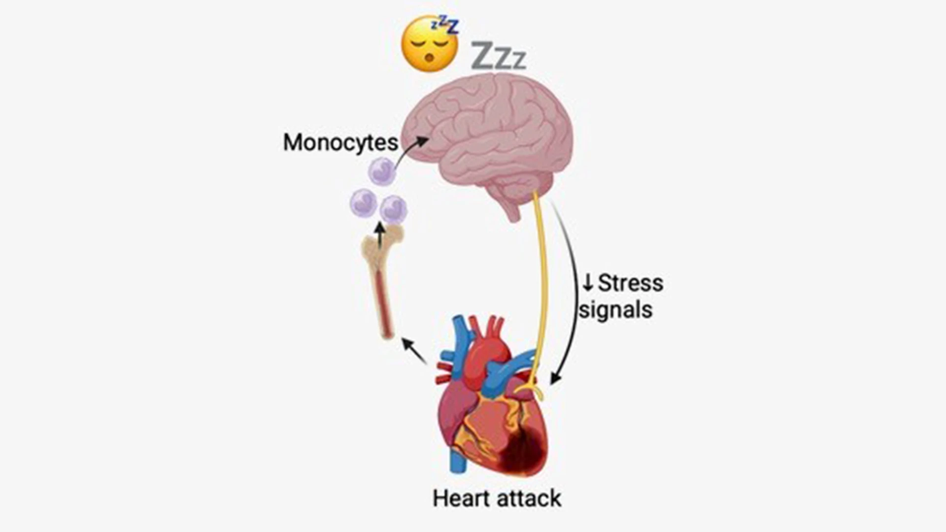 Schematic of hypothesized mechanism: After a heart attack, monocytes are released from the bone marrow and recruited to the brain where they produce TNF to increase sleep, which limits stress signaling to the heart and promotes heart healing and recovery. 