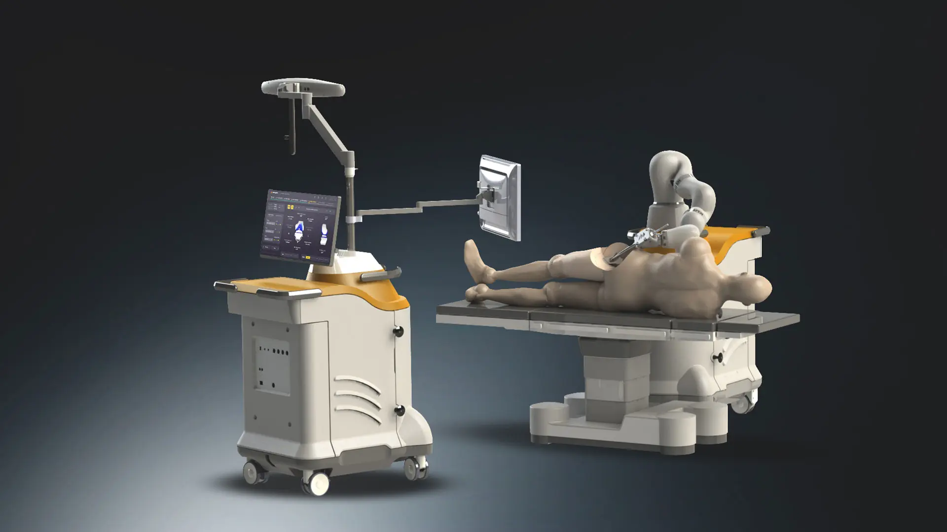Monogram Robotic System in the operating room SOURCE: Monogram Orthopedics