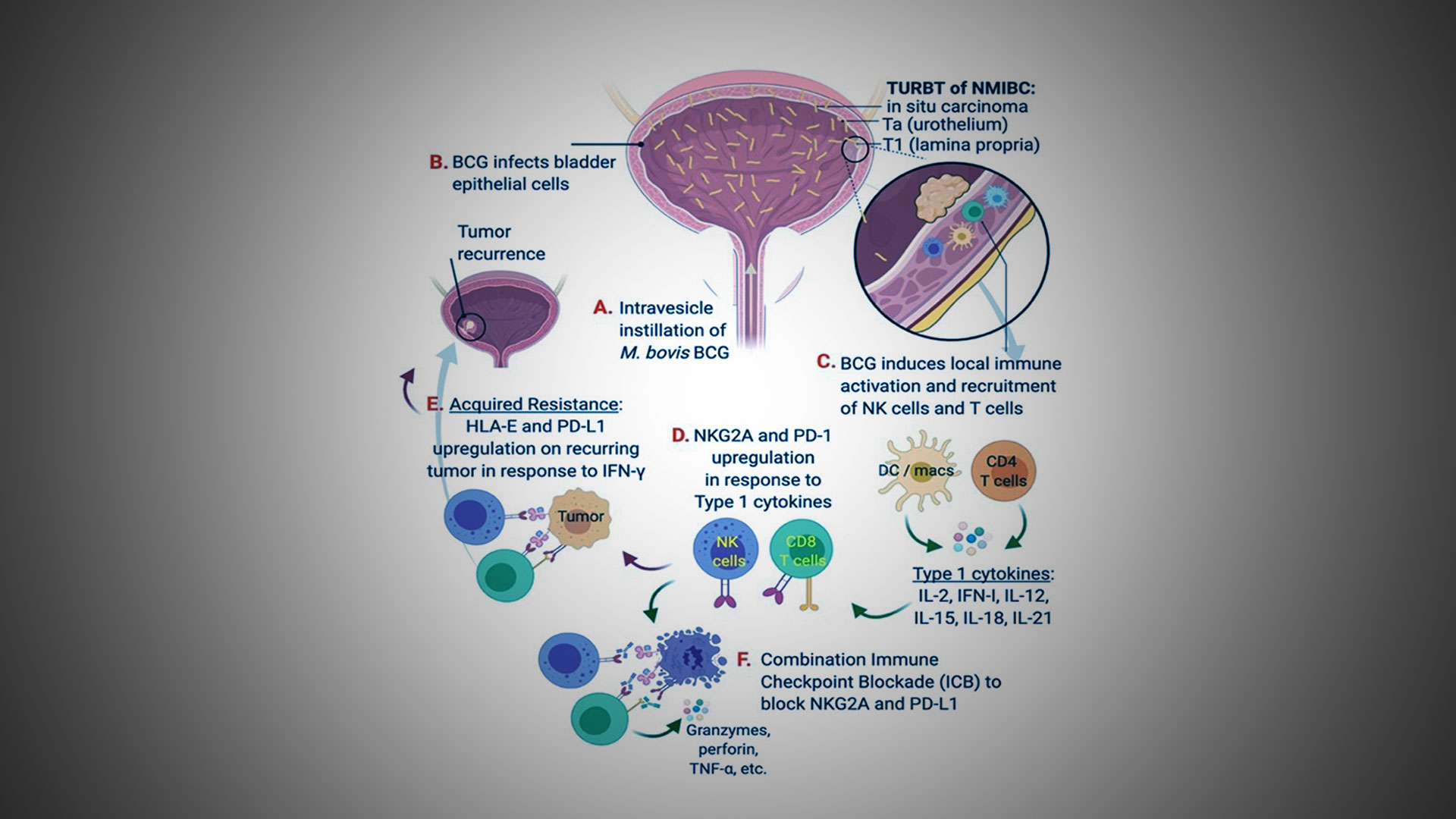 A Mount Sinai Team of Urologic Researchers Advances a Unique Model