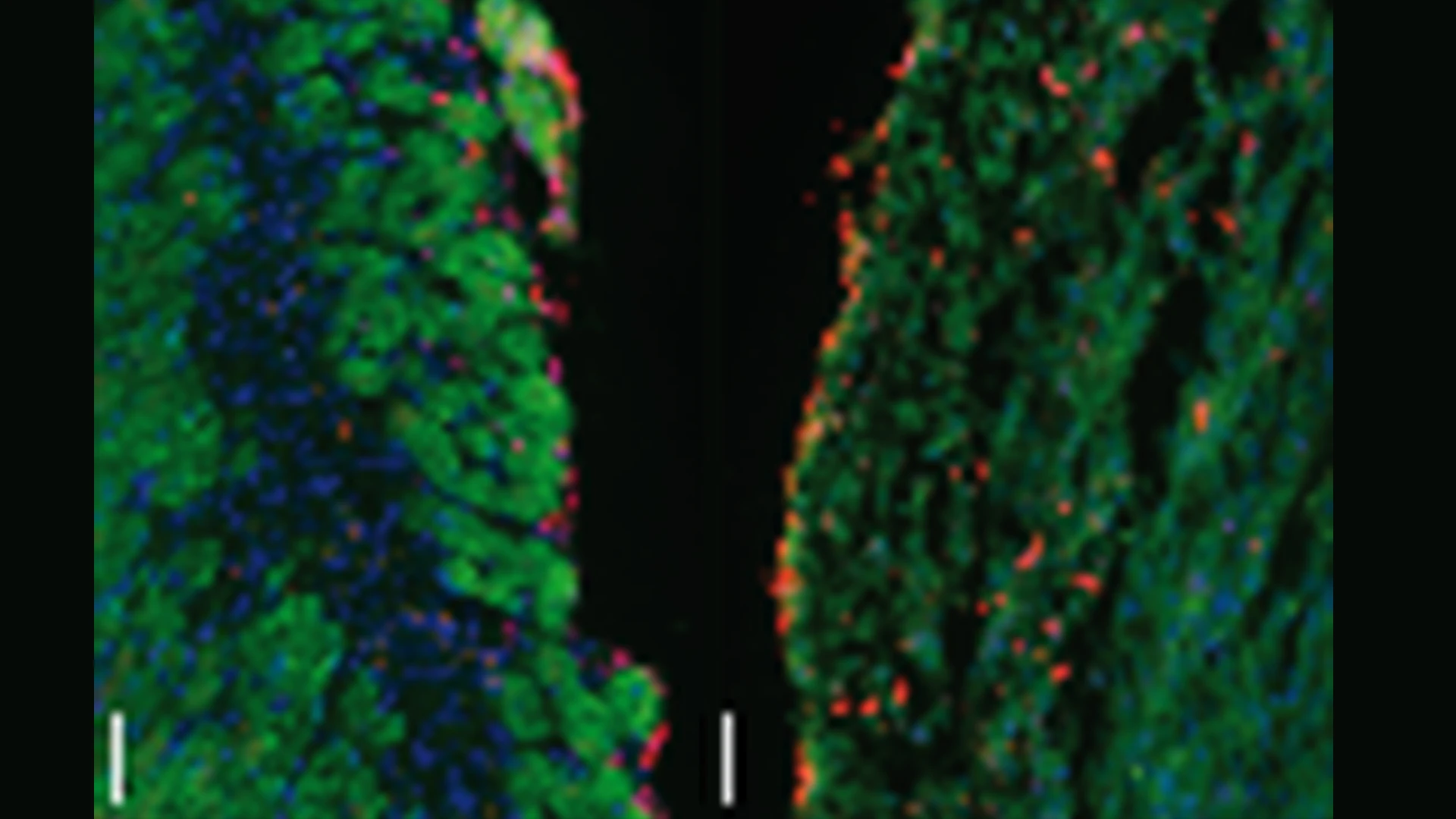  Lin28a cardiomyocyte-specific modRNA translational system (CM SMRT) substantially decreased the death of CMs compared to control seven days after MI. This suggests Lin28a has an additional cardio-protective function beyond its effect on cardiac regeneration post-MI.