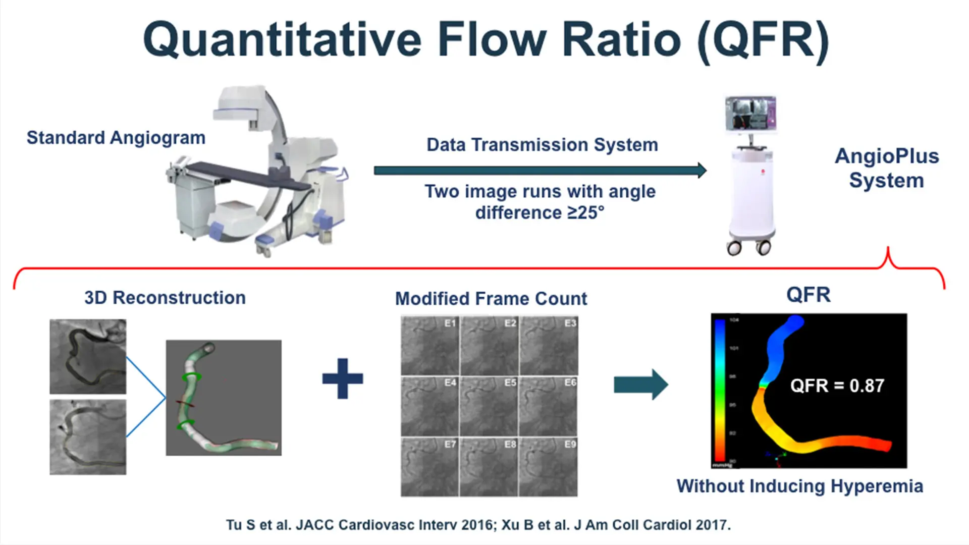 Quantitative flow ratio technology uses 3D artery reconstruction and measurement of blood flow velocity that gives precise measurements of the pressure drop across a blockage.