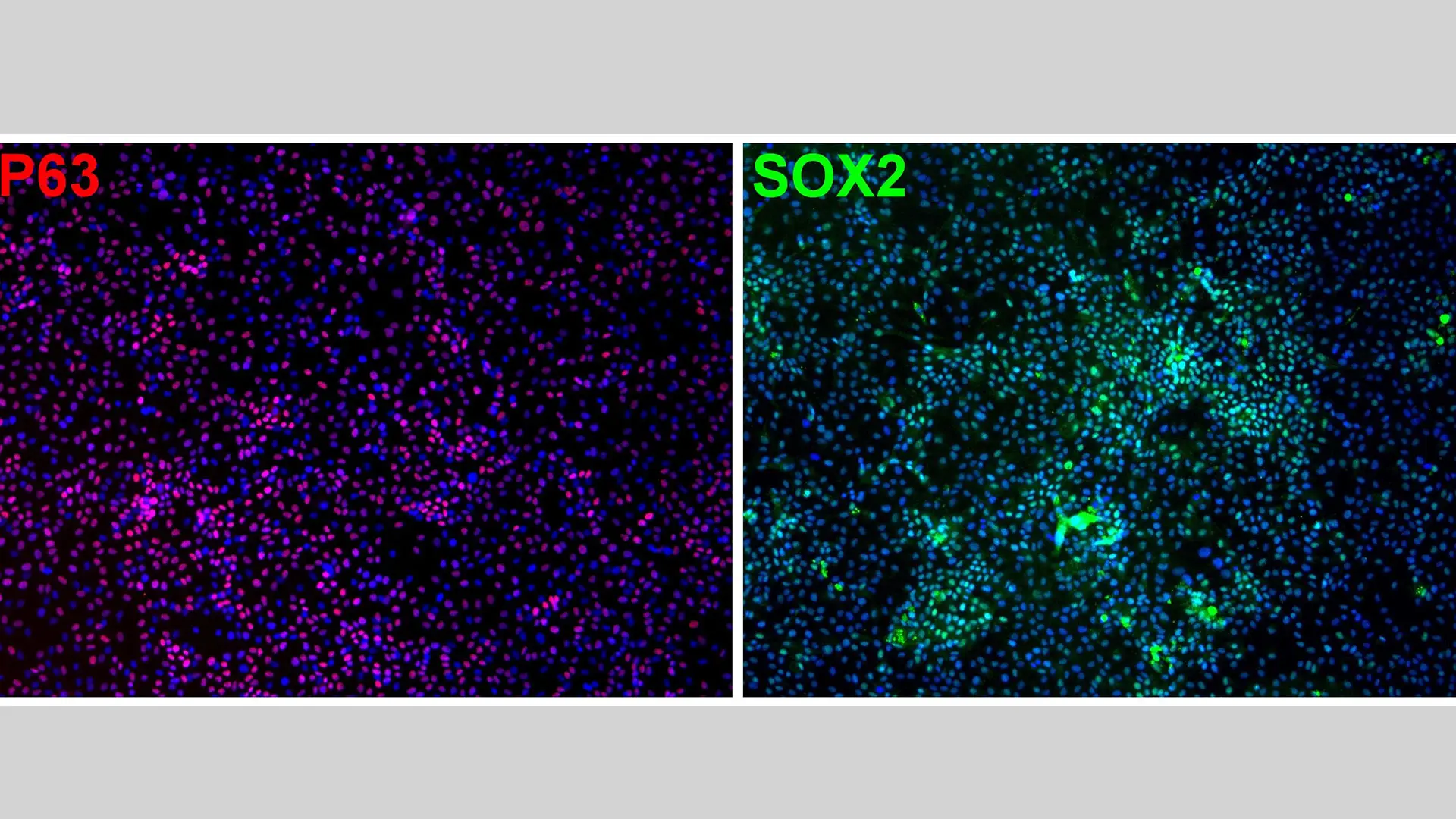 Immunofluorescence staining of markers expressed in basal cells. 