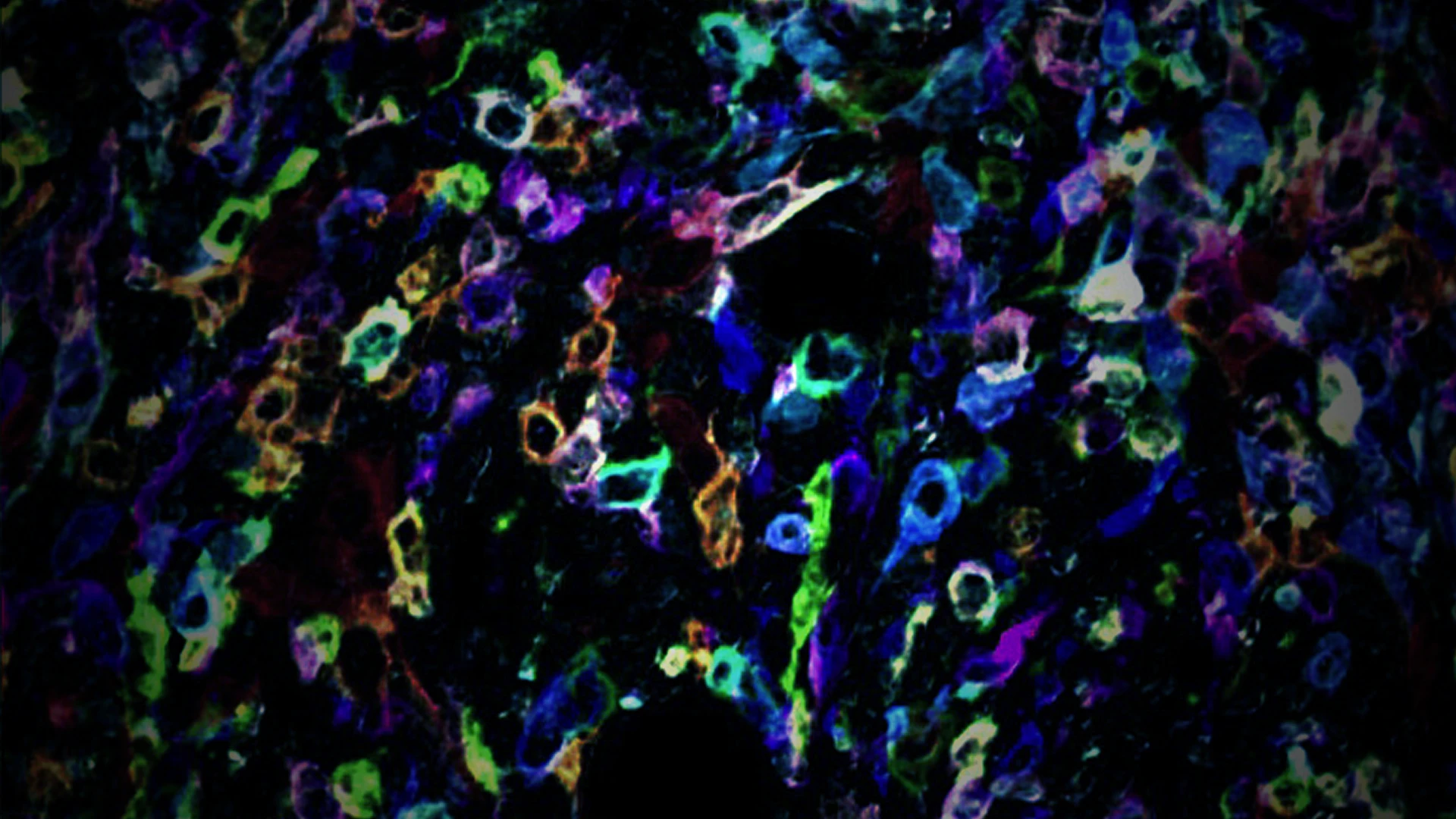 A Colorful New Approach to Identifying Regulators of the Tumor Microenvironment