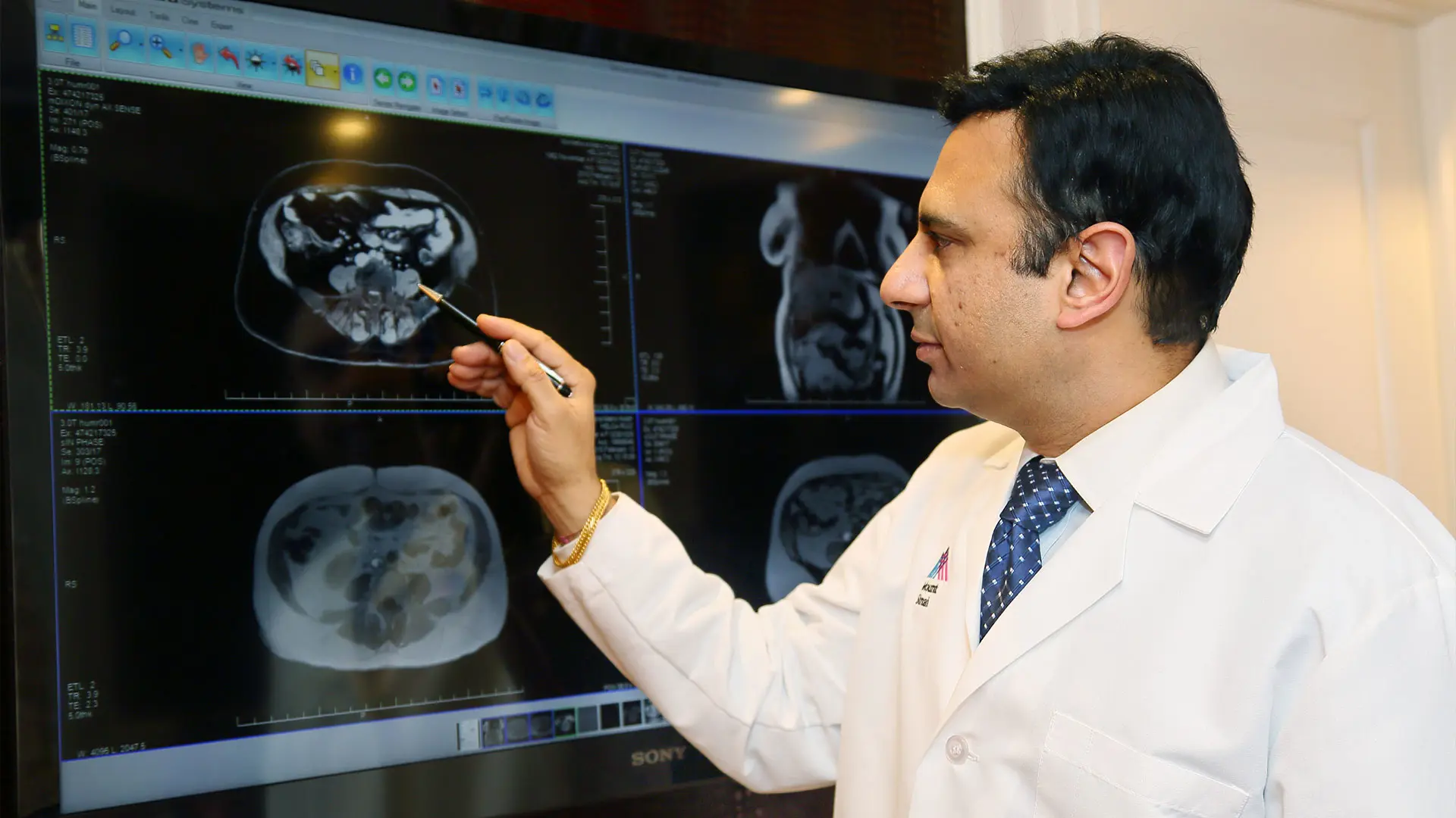 “There is always room to improve procedures we thought were good—to make them less harmful and more tolerable for patients,” says Mantu Gupta, MD, Professor of Urology, a pioneer in the field of percutaneous nephrolithotomy (PCNL). “As urologists, we should never be afraid to keep pushing the envelope.” 