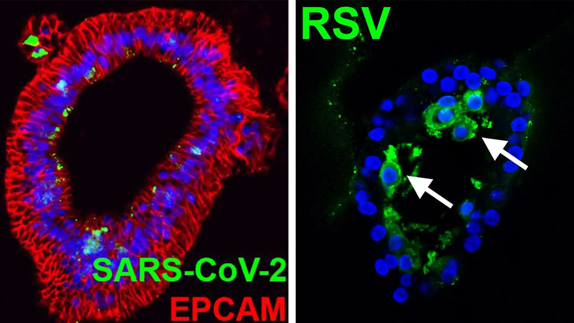 Confocal images of lung organoids infected with SARS-CoV-2 (NP) or RSV (arrows: infected cells in the lumen). 