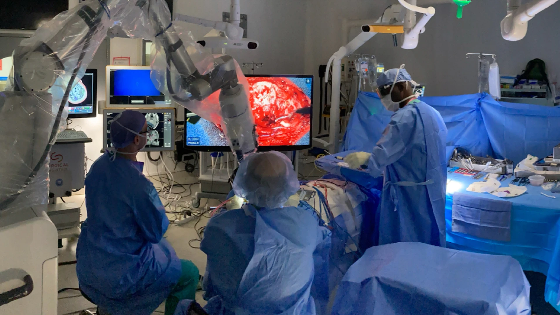 Bottom. Intraoperative setup including displays for frameless stereotactic neuronavigation, left; augmented reality overlay, 3D rendering of the operative field, and high-resolution electrocorticography by Precision Neuroscience, far right. Neurosurgeon Joshua B. Bederson, MD, is positioned at head of patient.  