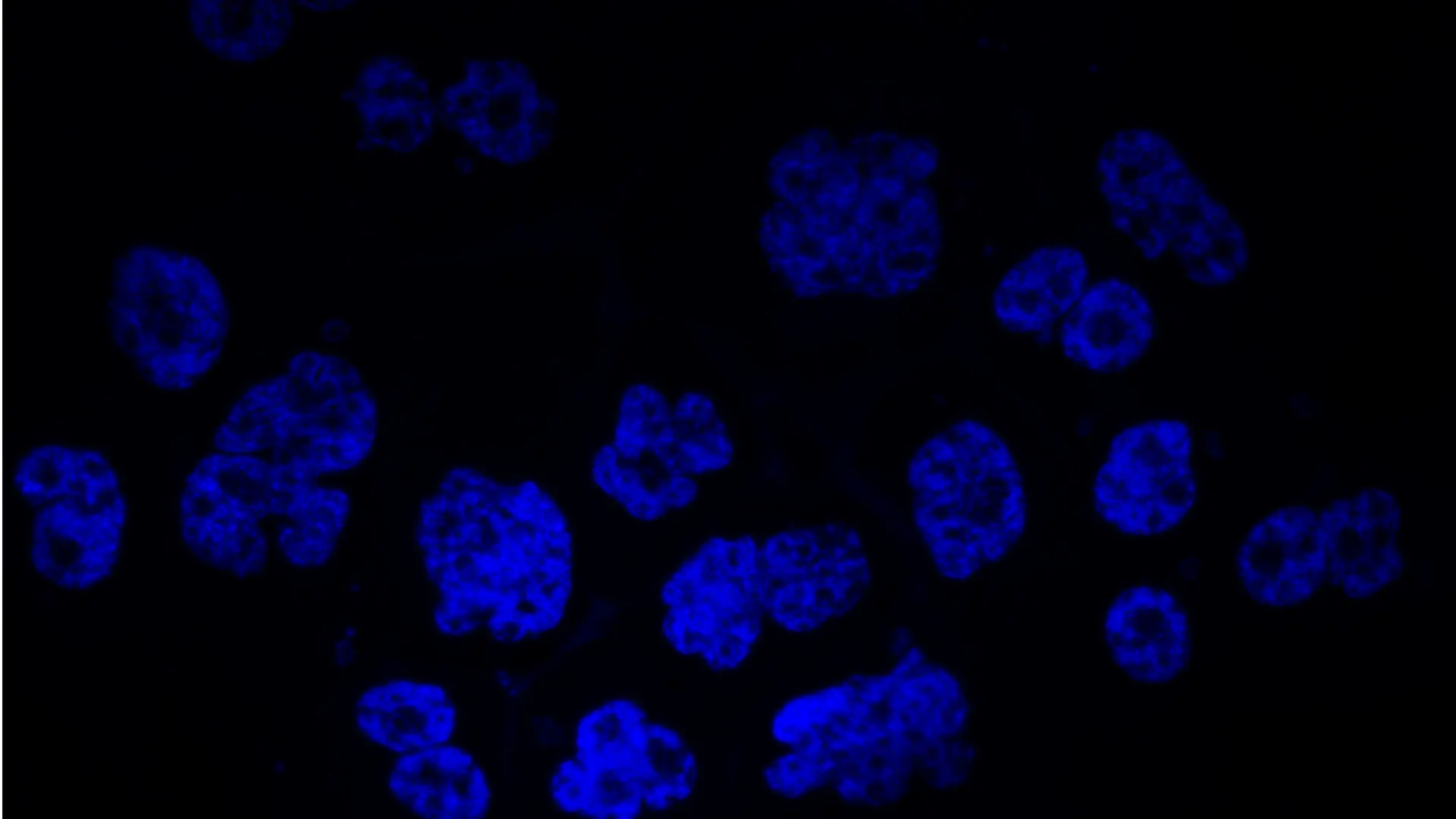 Human prostate cancer cells treated with MS21 have reduced levels of the AURKB protein and cannot successfully divide. 
