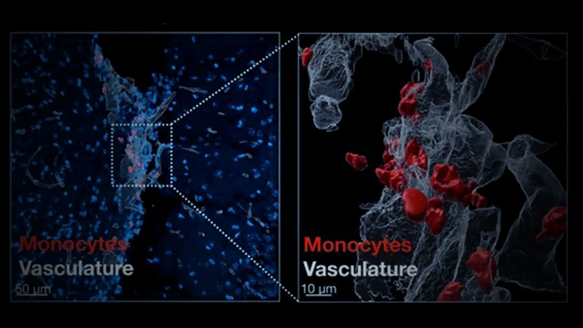 After Myocardial Infarction, the Heart Signals to the Brain to Increase Sleep and Promote Healing