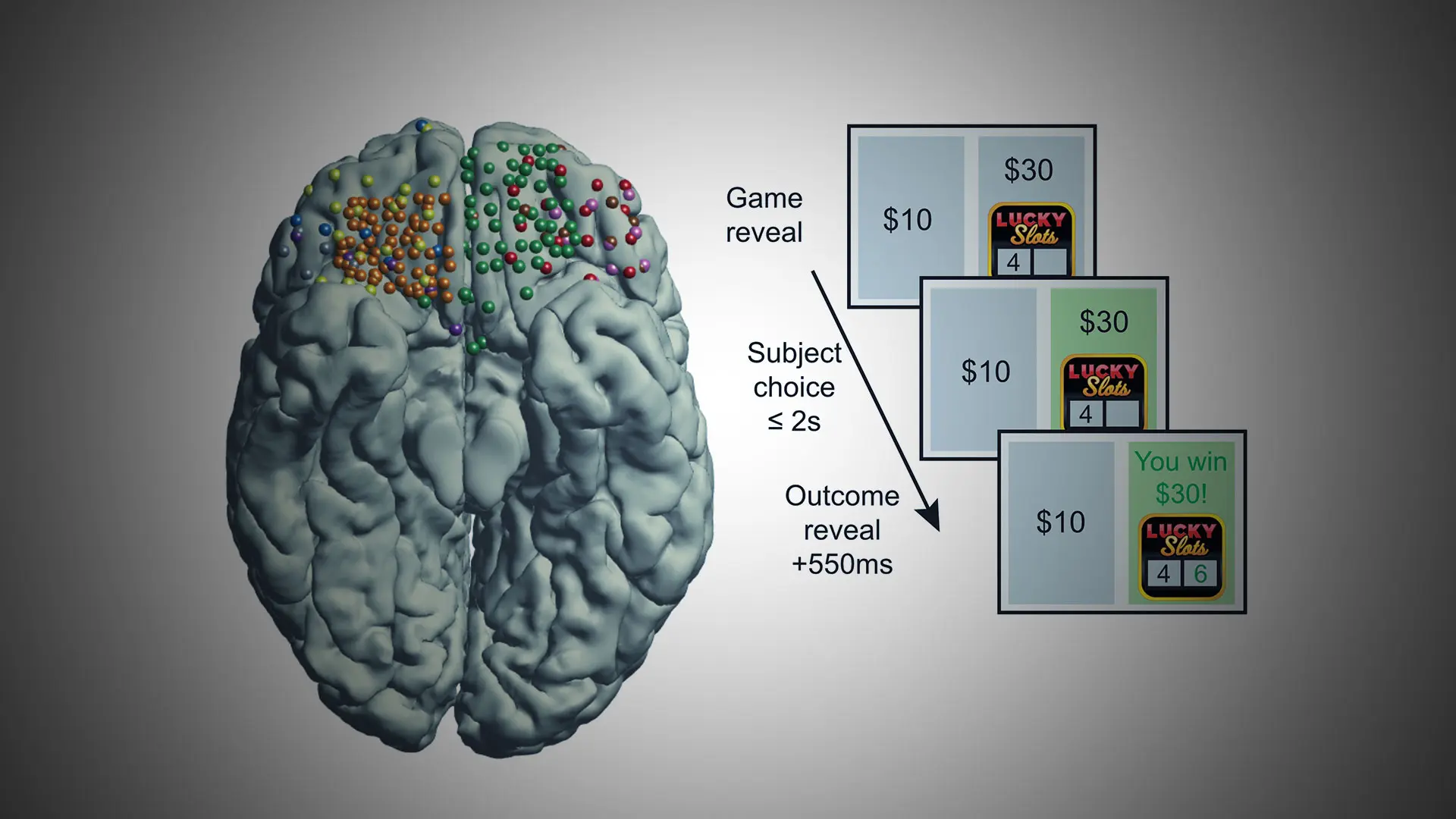 Utilizing Recordings From Human Brain To Understand Brain Function 