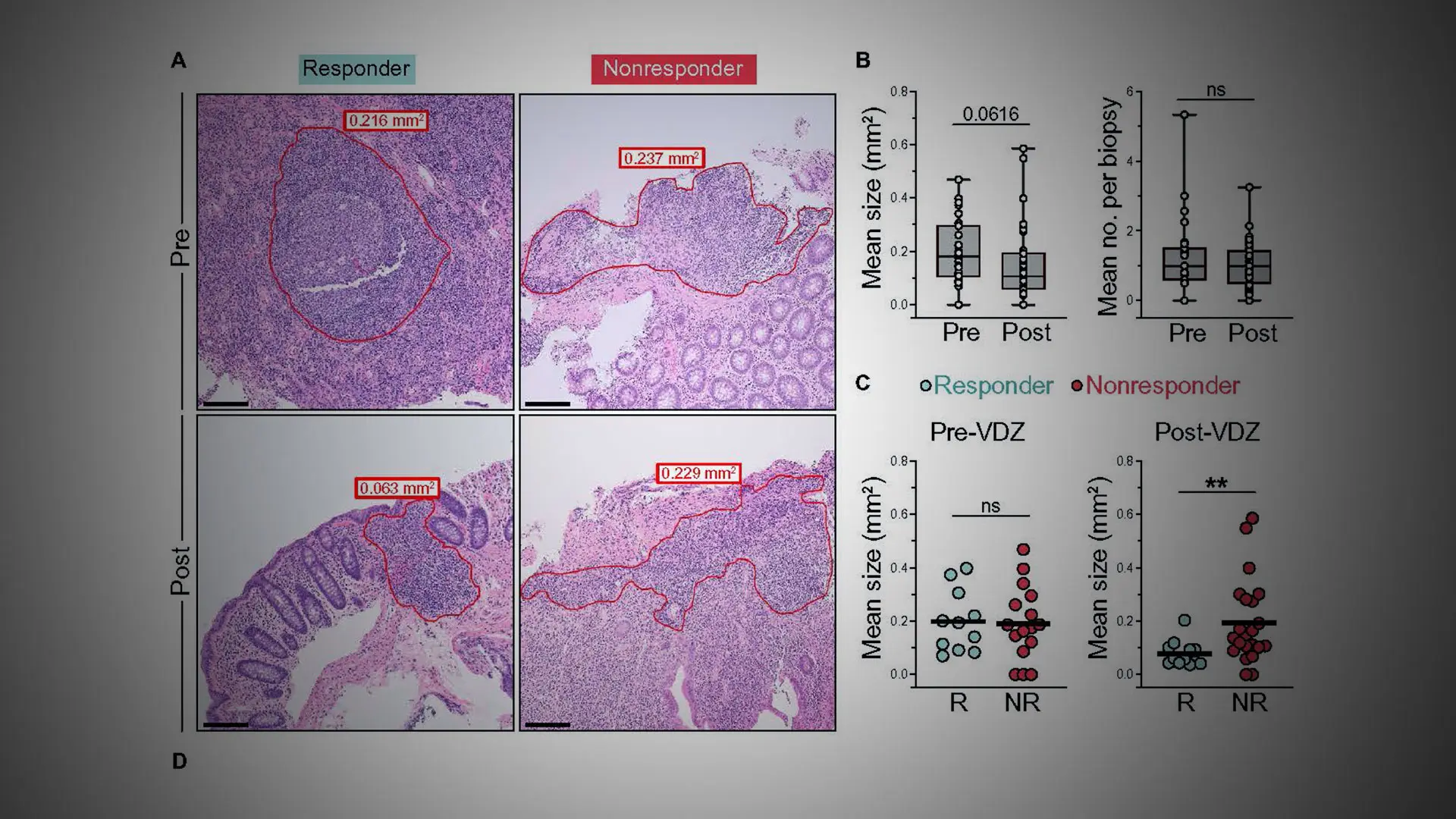 Researchers Are a Step Closer to Understanding How a Highly Successful IBD Drug Works