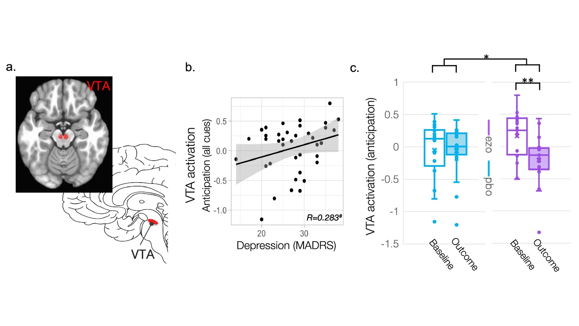 A concurrent imaging study, published in Molecular Psychiatry, explored ezogabine's ability to affect the ventral tegmental area (VTA), shown in figure A. Among individuals with depression, higher VTA activation during anticipation was associated with more severe depressive symptoms, seen in figure B. The team also found that ezogabine normalized hyperactivity of the VTA among people with depression and anhedonia symptoms, compared to those administered placebo, seen in figure C.