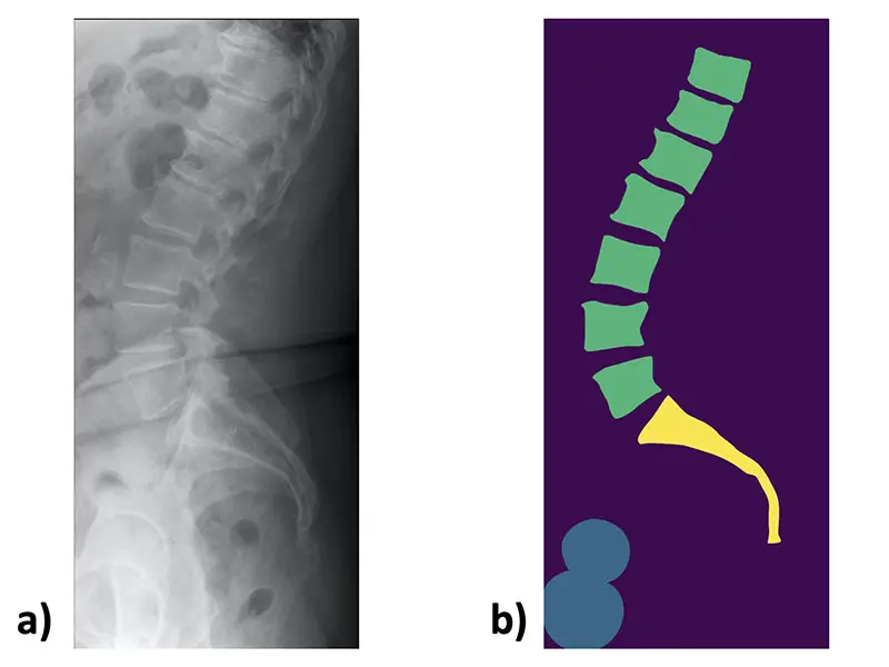  An example lateral lumbar radiograph a) and the corresponding manually created mask b)