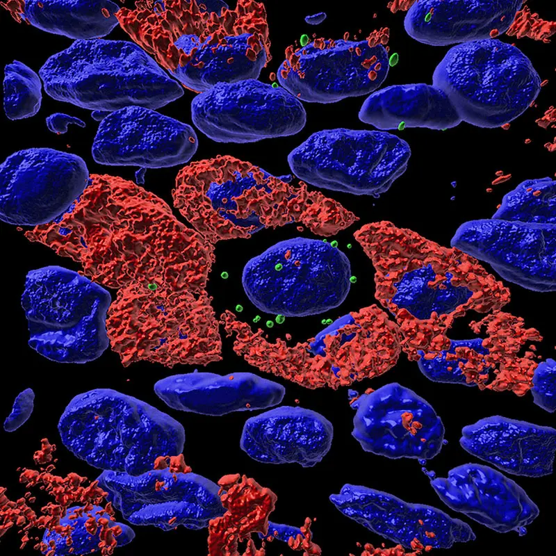 3D image rendering of cells of the airway epithelium. Target RNA highlighted in green, cellular mucus production shown in red, and cell nuclei shown in blue. 