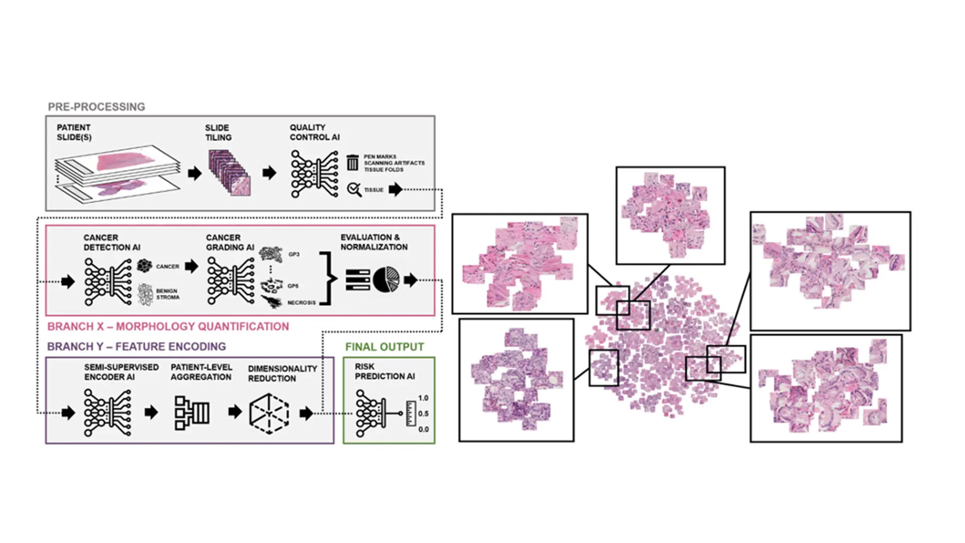 Researchers Develop New AI Tool That Could Reshape Prostate Cancer Care