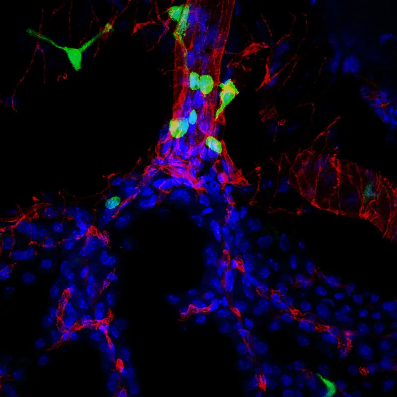 Peripheral monocytes accumulate in the choroid plexus. (Created by Flurin Cathomas, MD, postdoctoral fellow, and Carrie Hsiao-Yun Lin, visiting postdoctoral fellow, Russo lab.) 

 
  





