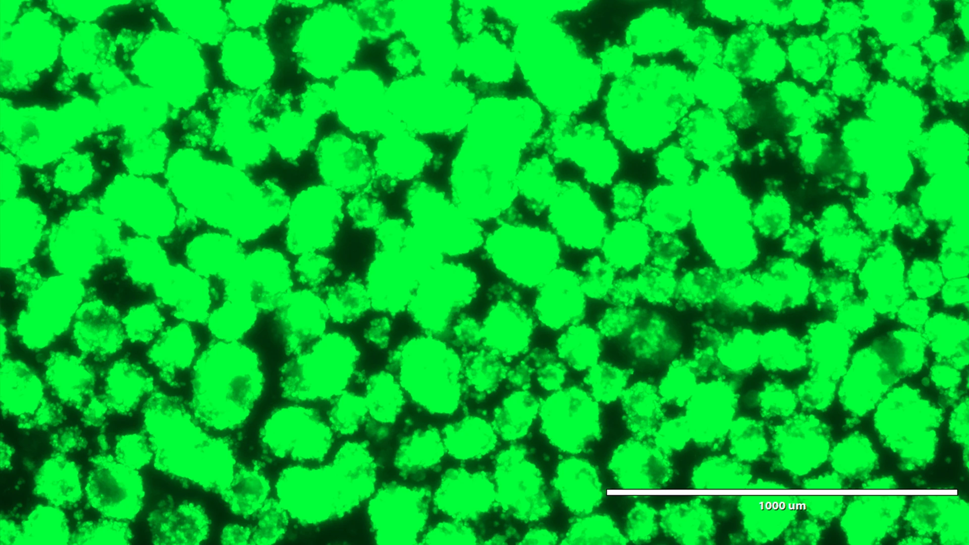 Human pseudoislets five days after lentiviral transduction with a shRNA and a reporter gene under bright light, and blue light.