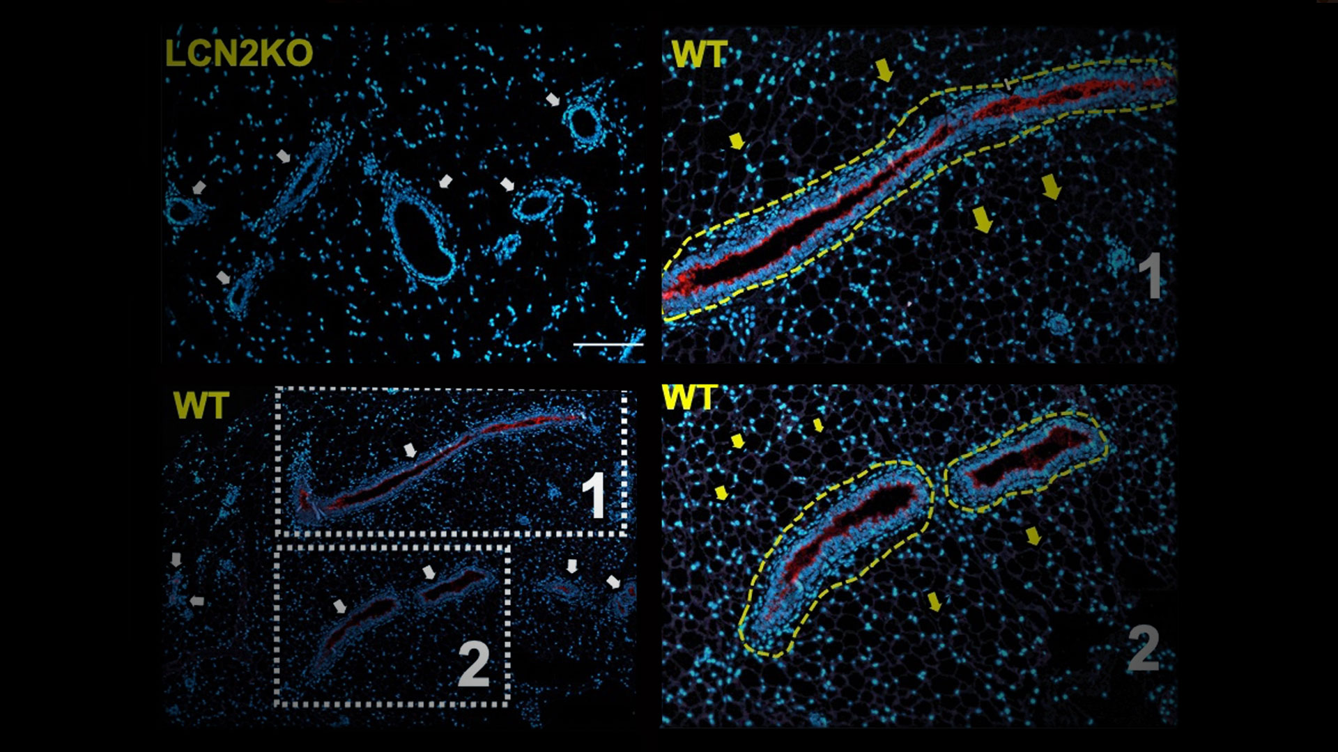 Mount Sinai Researchers Discover “Mammokines,” Molecules in the