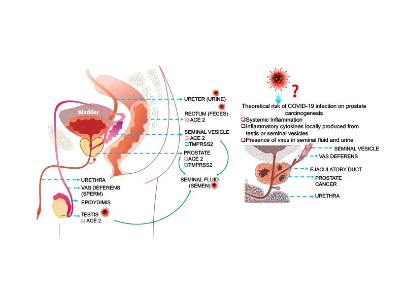 Graphical representation of the theoretical risks and potential routes of dissemination of SARS-CoV-2 to the prostate.