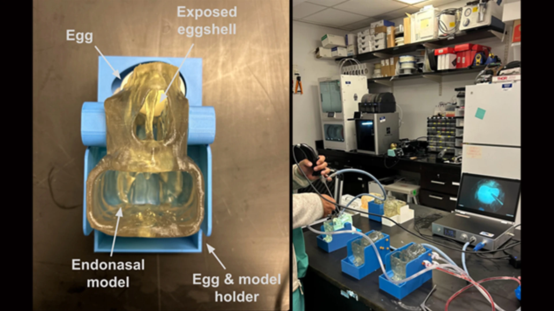 Figure 2. Endoscopic Skull Base Simulation model. This model fuses a 3D-printed human endoscopic model with the natural tissue properties of a raw chicken egg to simulate the experience of performing endoscopic osteotomies and durotomies. The tissue interface between the calcium eggshell and the yolk membrane replicates the surgical experience with high fidelity. 