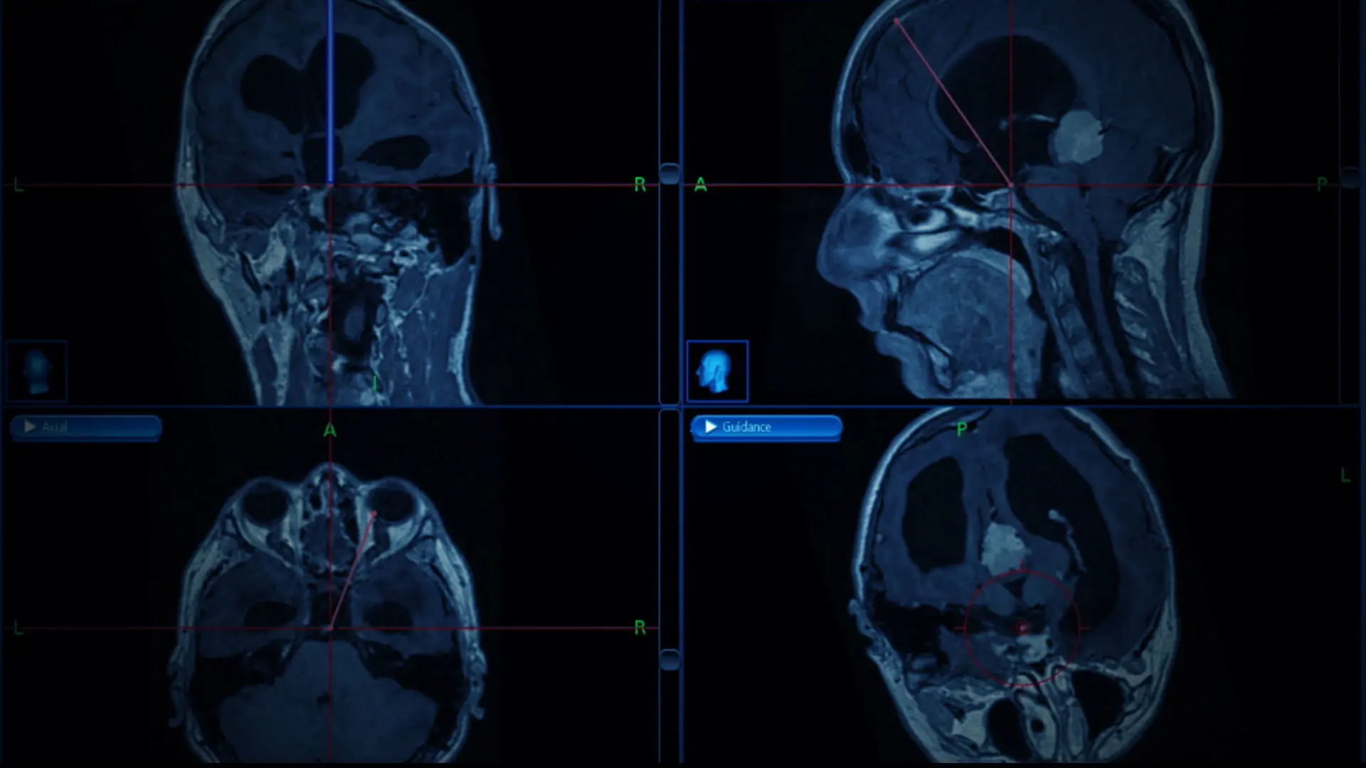 Neurology and Neurosurgery 