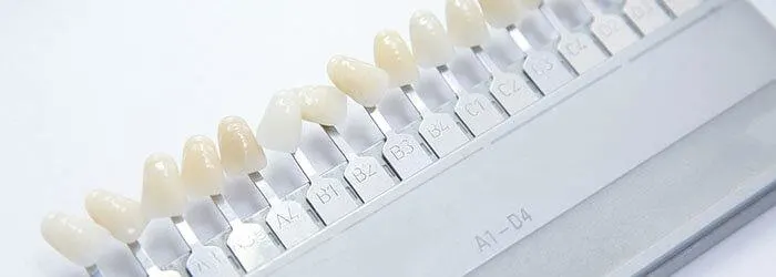 Dental Veneers - What to Expect  article banner