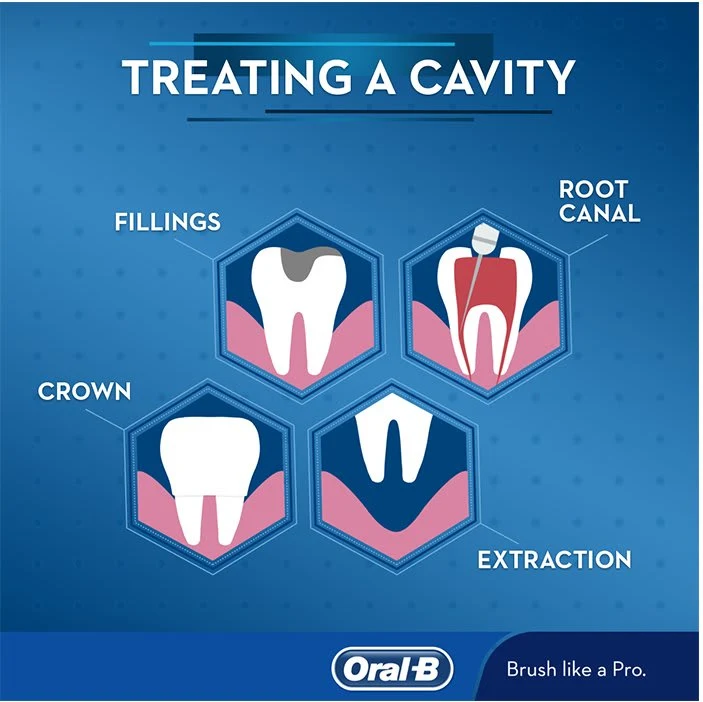 Article Cavities Treatment: Ways to Treat Cavities - Image 1