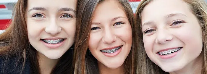 Types of Braces article banner