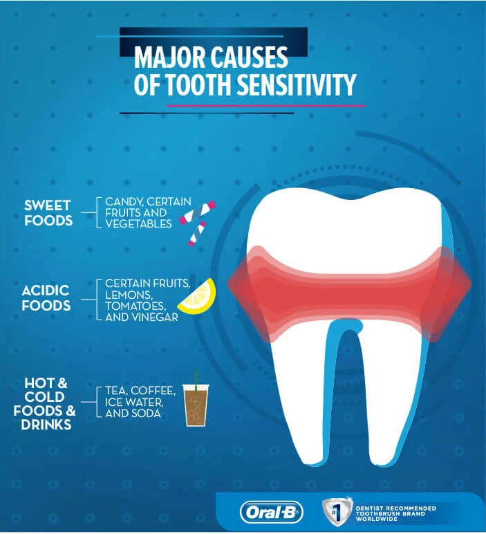 Article Sensitive Teeth: Causes, Treatments, and Prevention - Image 1 