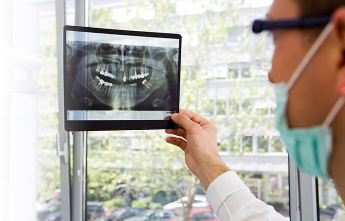 What is a Cavity and What Causes Tooth Decay?