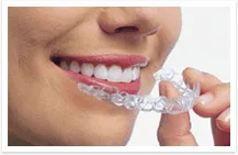 Invisalign 