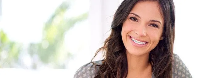 Types of Adult Braces in New Zealand: Choosing the Best Option for a  Straighter Smile