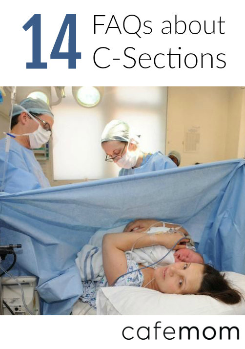 14 Questions to Ask About C-Sections (Even if You're Not Planning One ...