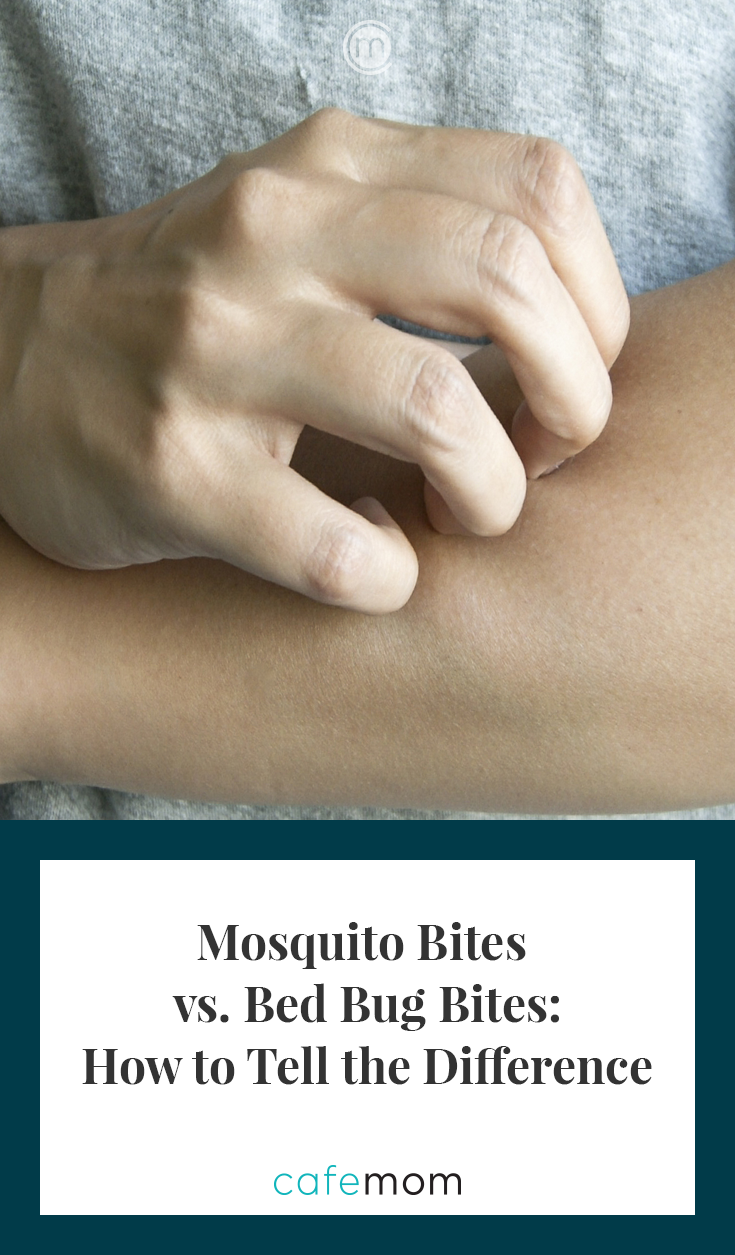 Mosquito Bites Vs. Bed Bug Bites: How To Tell The Difference | CafeMom.com