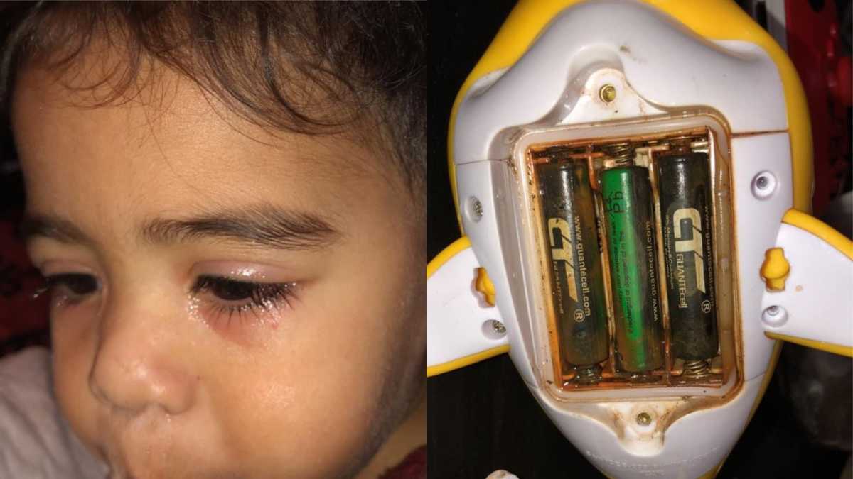 Mom's viral warning on tub toys after toddler's terrifying infection - Good  Morning America