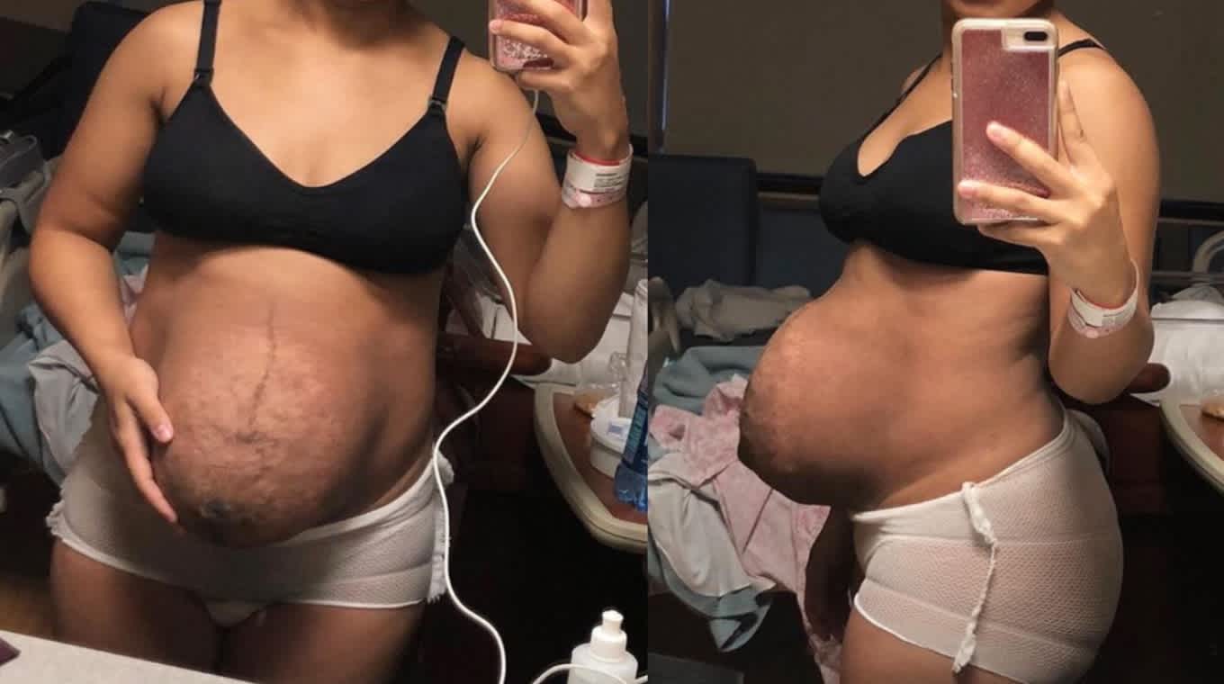 29 Moms Shared Photos Of Their Bodies Right After Giving Birth And It  Perfectly Shows The Beauty Of Motherhood