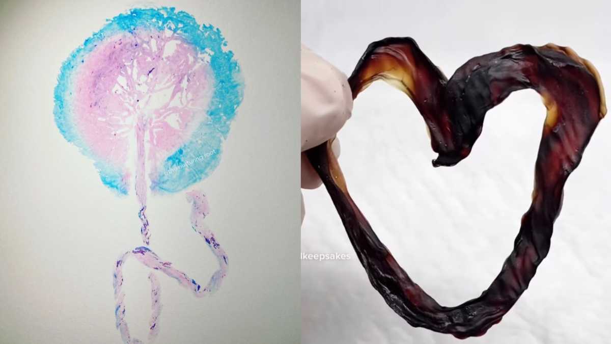 The mother who is turning umbilical cords into art