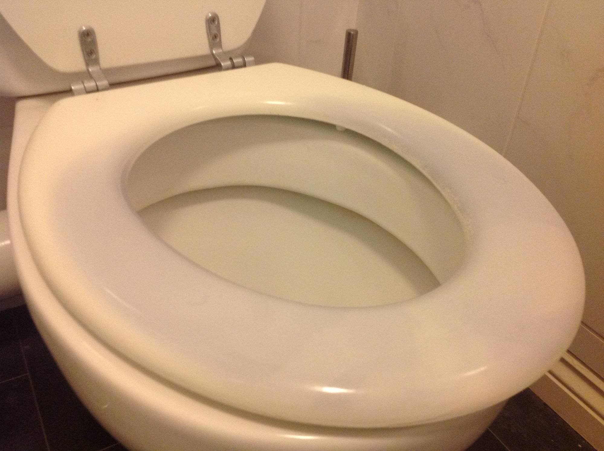 Pregnant Women Say Their Toilet Seats Are Turning Blue