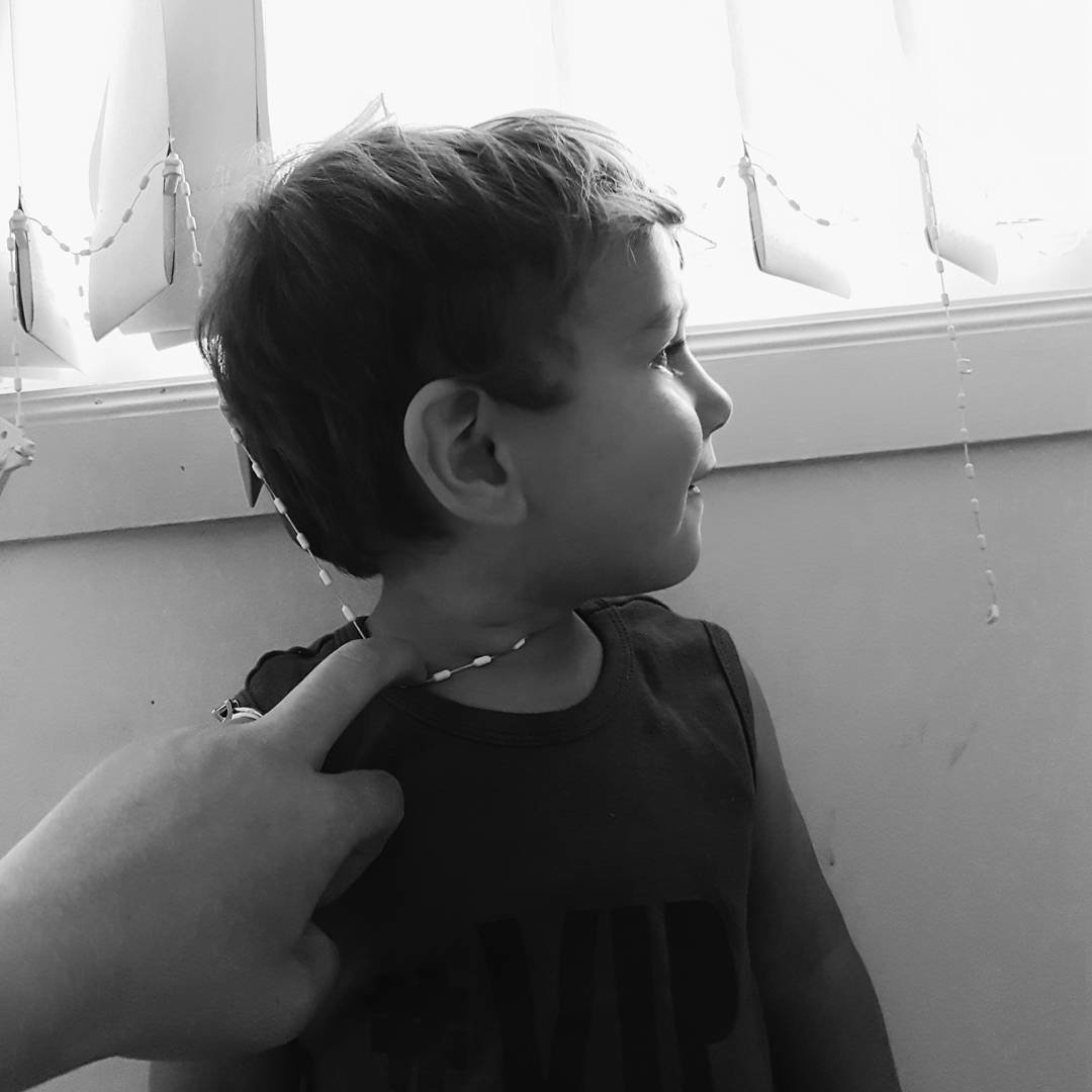 Why This Mom Posted a Picture of Her 'Strangled' Toddler