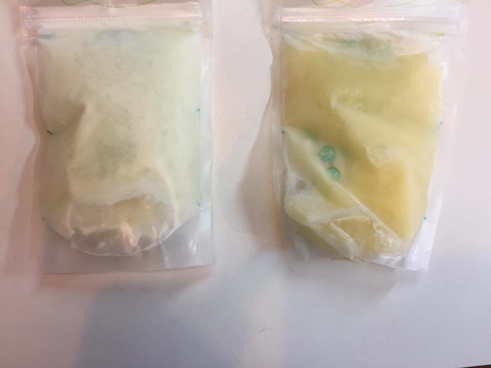 Photo Shows How Mom's Breast Milk Changed to Treat Her Baby's Flu