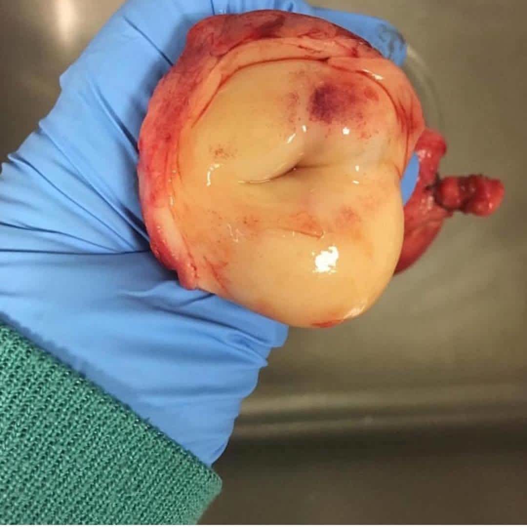 This Is What A Cervix Looks Like Its Incre