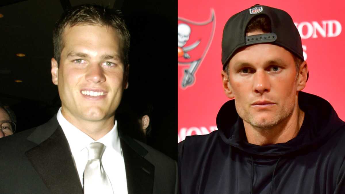 Tom Brady's Drastically Changing Face Reignites Rumors He's Had