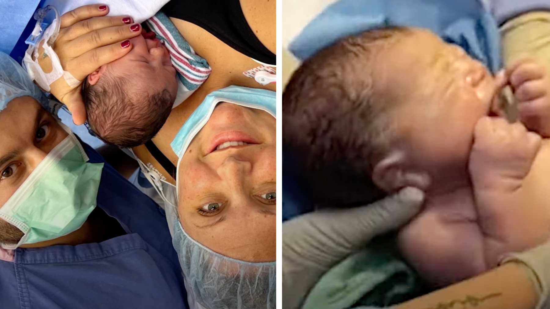Mom Gets To Watch Her Own C Section Thanks To A Camera Used During Her