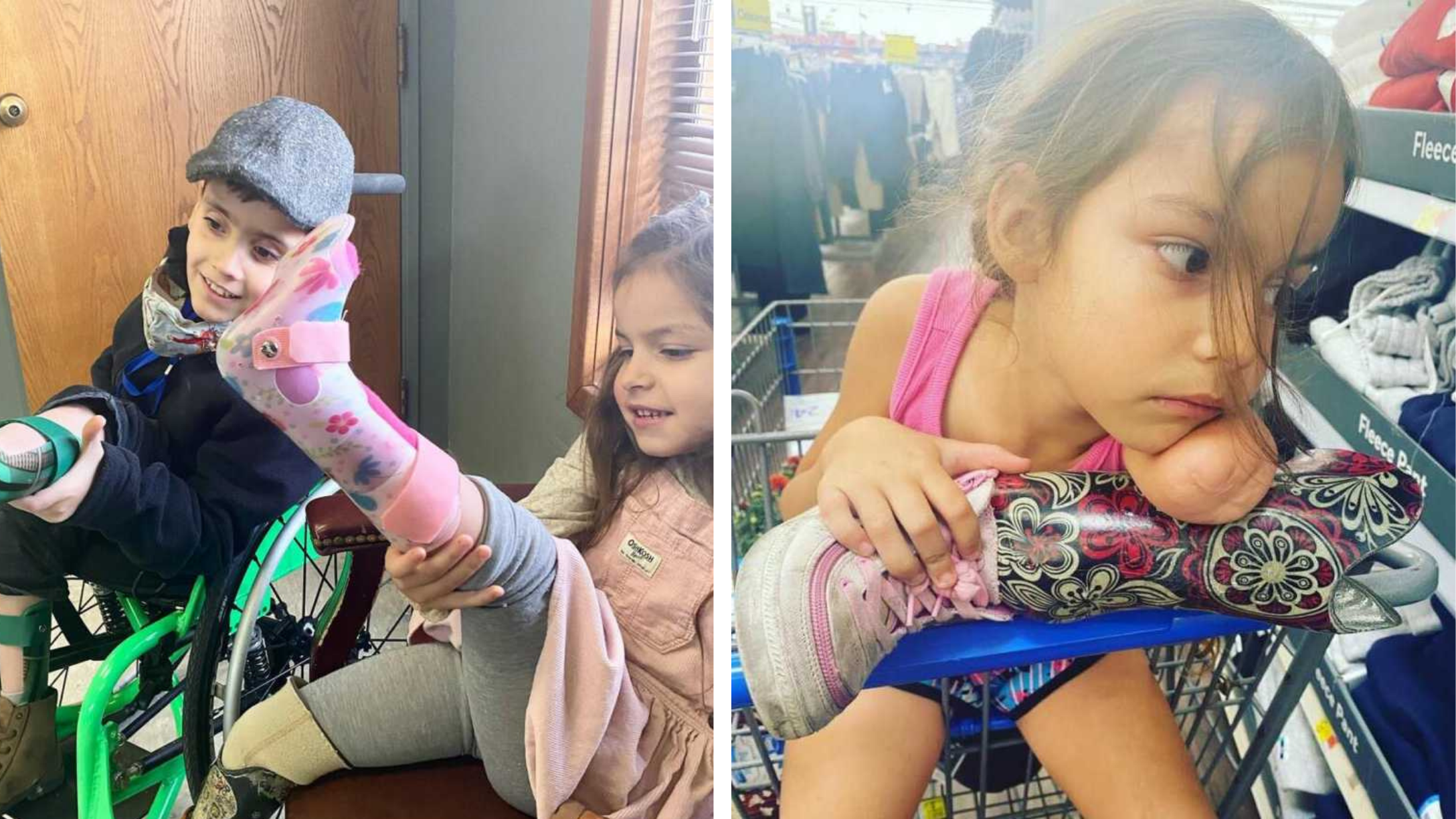 Mom Shares Lesson Learned After Cashier Makes Joke About 3-Year-Old With  Missing Limbs | CafeMom.com