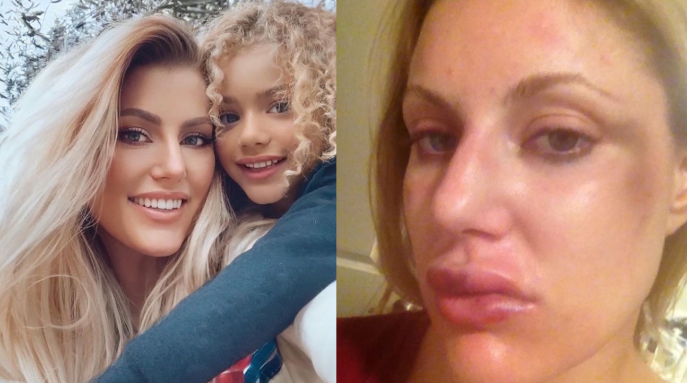 Mom Reveals How NFL Players Brain Injury Transformed Him Into Abusive Demon in Raw Post CafeMom pic
