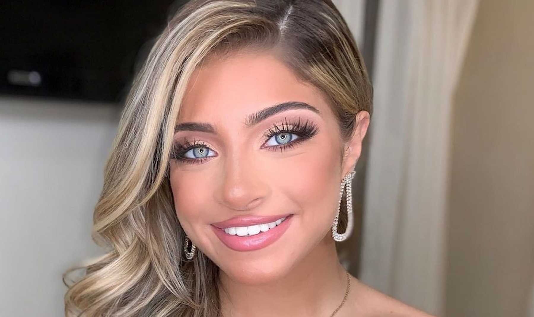 Rhonj Star Teresa Giudice S Year Old Daughter Gia S Plastic Surgery Transformation Cafemom Com